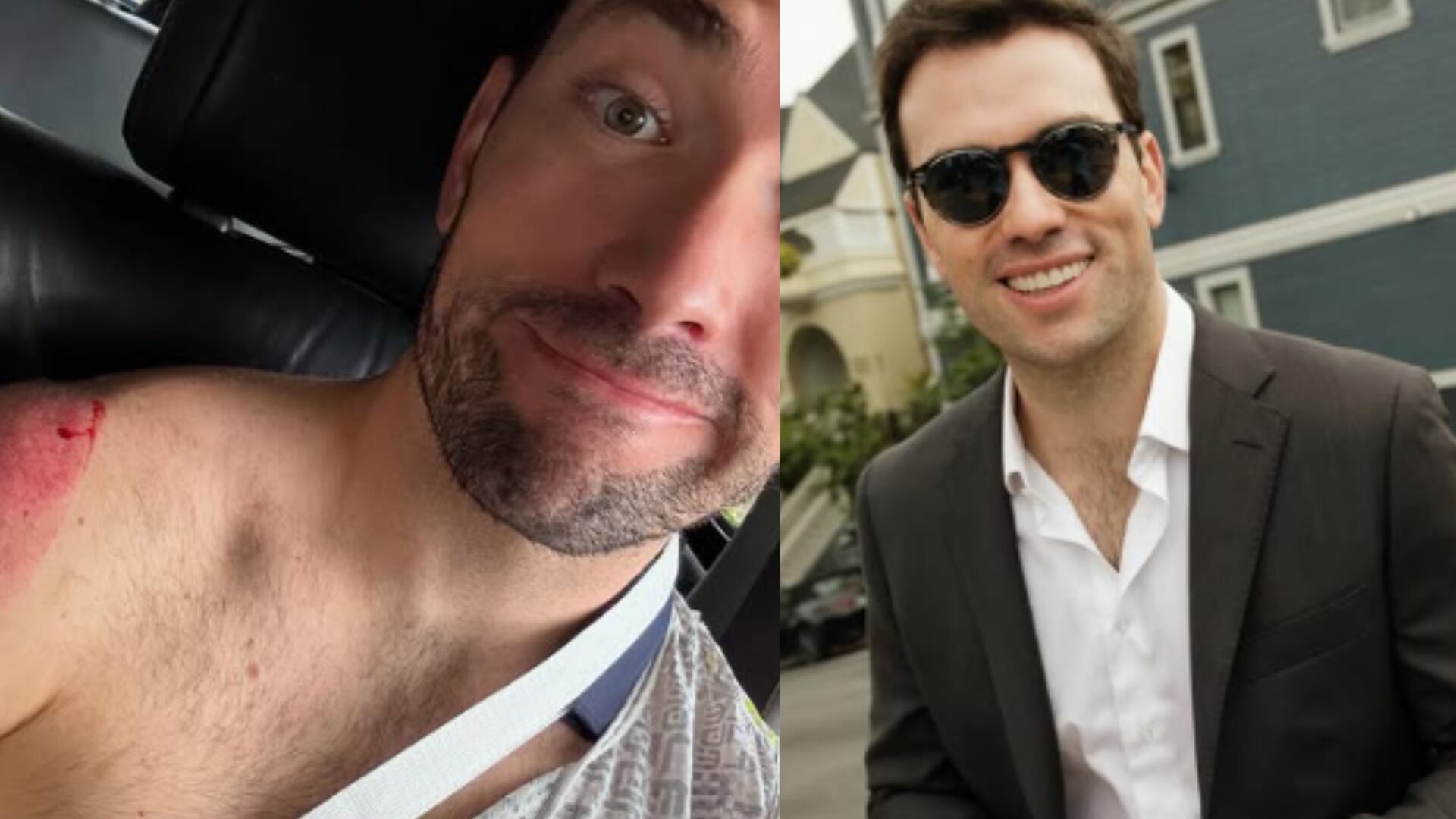 Esteban Santos tuvo un preocupante accidente en bicicleta que lo mandó al hospital