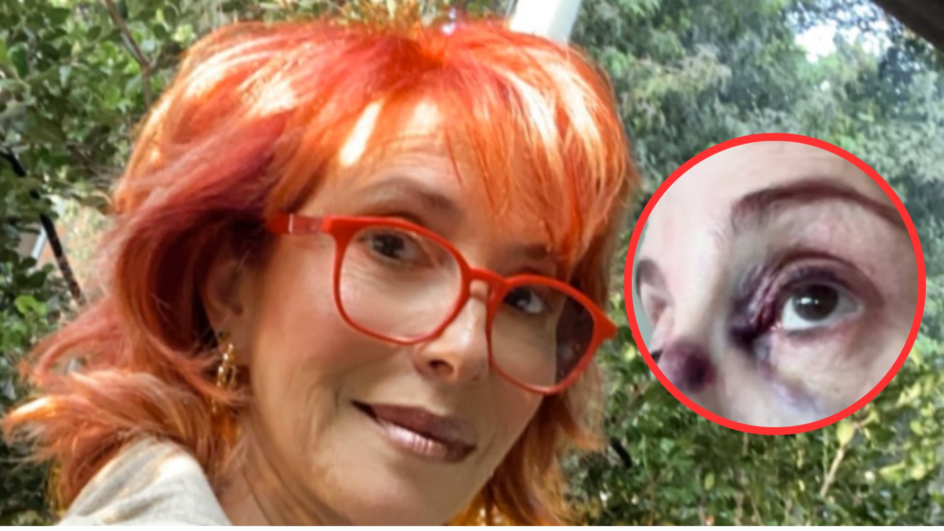 Yaneth Waldman sufrió apparatoso accidente laboral