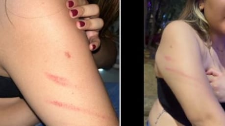 Joven denuncia agresión en discoteca en Provenza