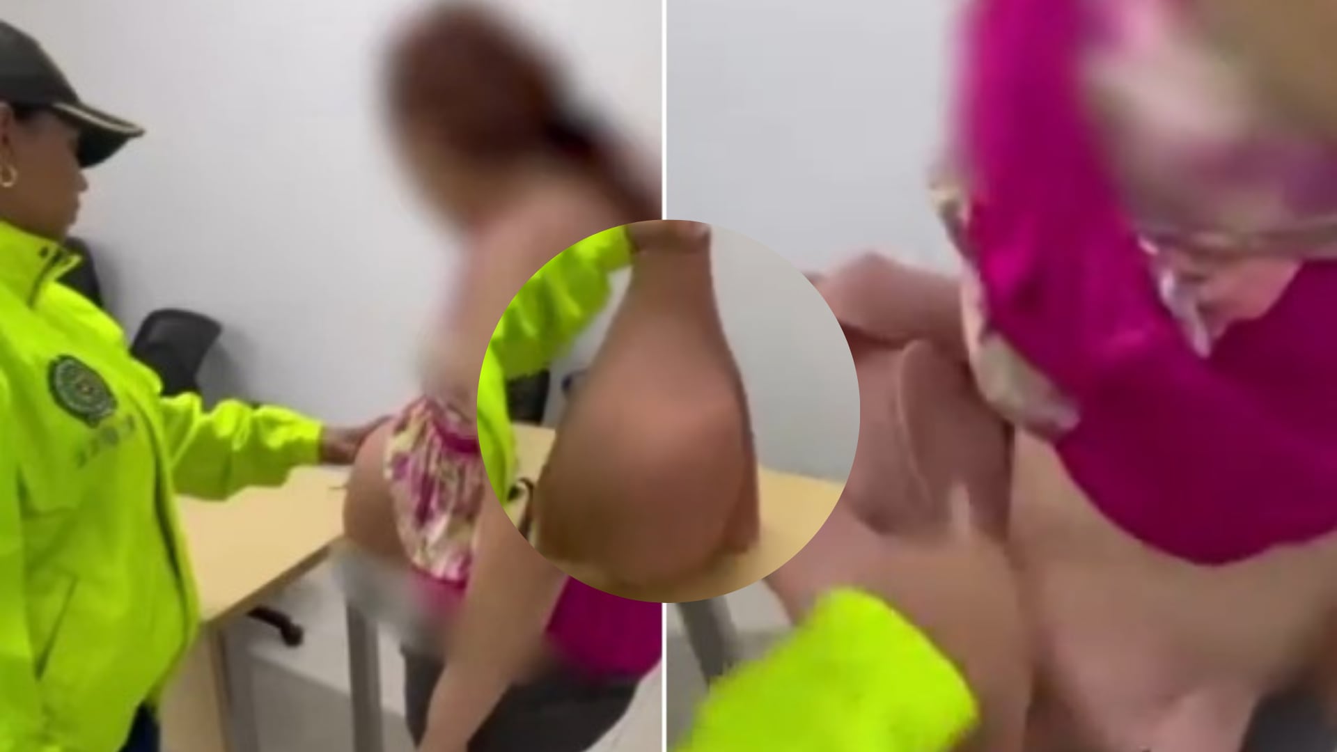 Barriga sintética con droga.