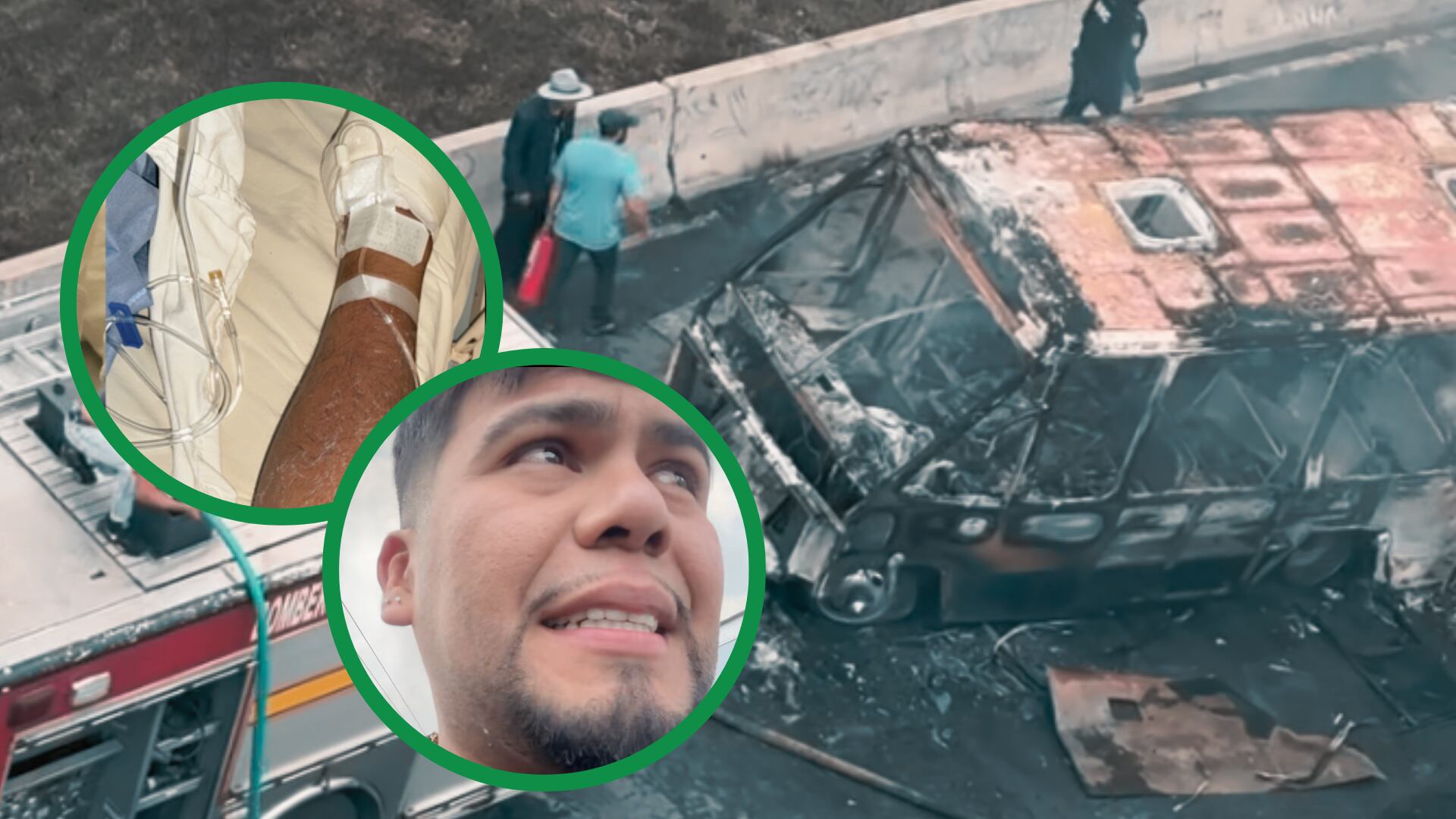 Entre los sobrevivientes se encontraba el influencer J LU Barber, quien mostró en redes las quemaduras en su brazo tras la explosión