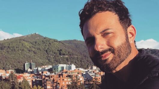 El actor Mario Espitia se sometió al implante de cabello.