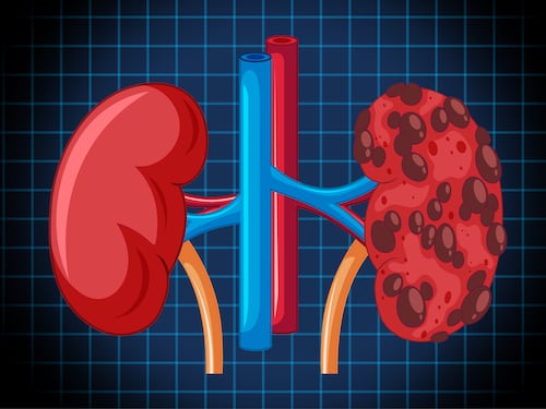 Aprenda a mantener saludables sus riñones con estas recomendaciones