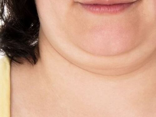 El ejercicio para eliminar la papada