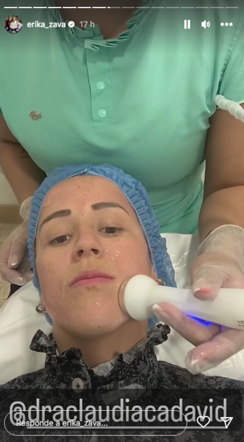 Erika Zapata se hizo limpieza facial por daño de su piel