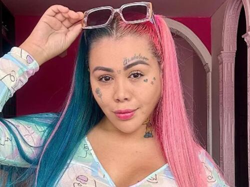 “Deforme y grotesca”: Yina Calderón muestra el espantoso estado de su cola