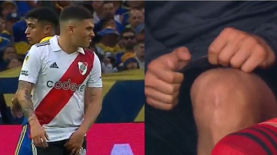 Molestia muscular de Juan Fernando Quintero