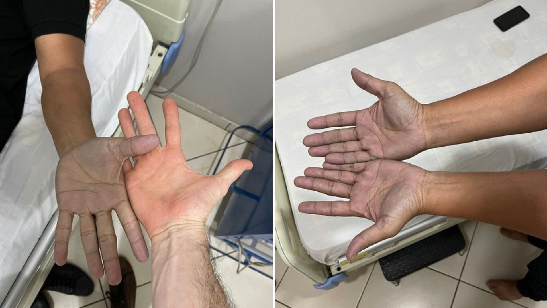 Historia viral manos azules blue jean