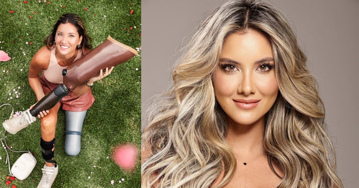 Daniela Álvarez mostró cómo su amputación y el estado de su otro pie no le impiden cumplir su pasión – Publimetro Colombia