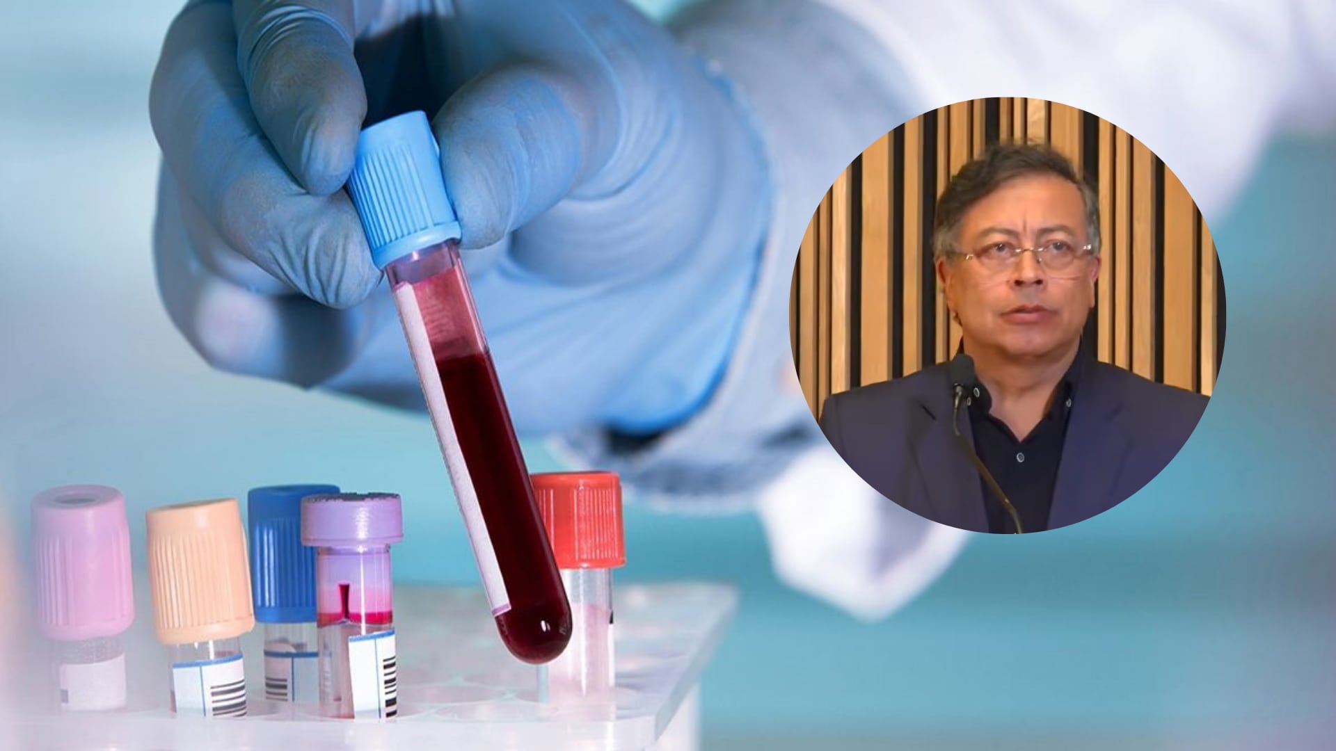 Polémica por menor que falleció por falta de medicamento para tratar la hemofilia.