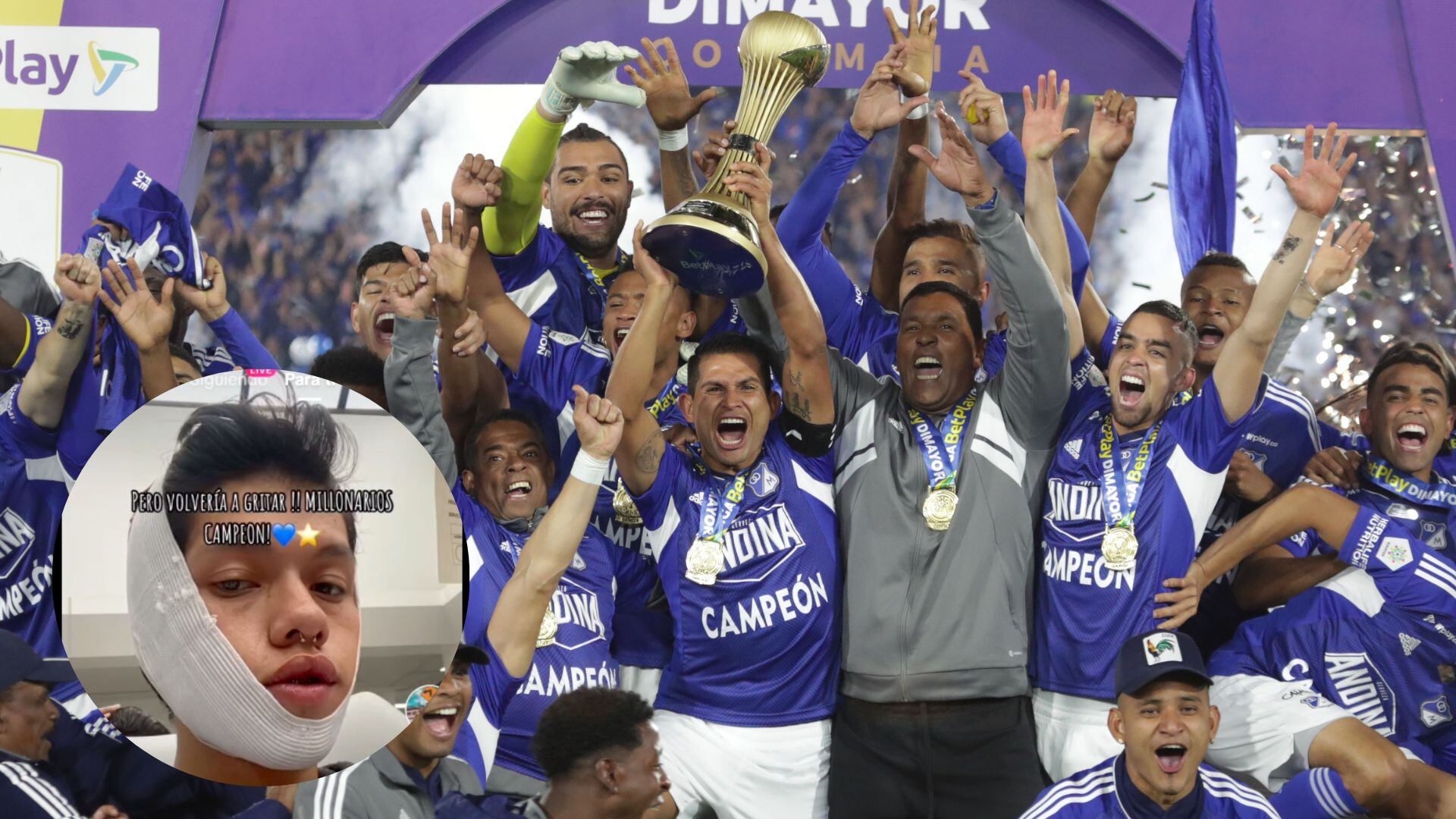 Aficionado de Millonarios tuvo curiosa lesión tras el título ante Nacional.