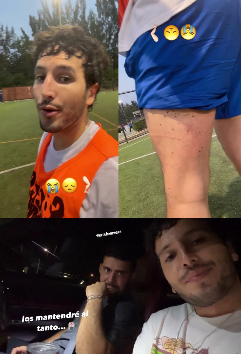 Sebastián Yatra sufrió un fuerte lesión que lo alejaría de los escenarios por varias semanas