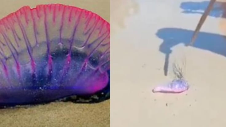 Turista fue picada por fragata portuguesa en playas de Bocagrande, en Cartagena: video.
