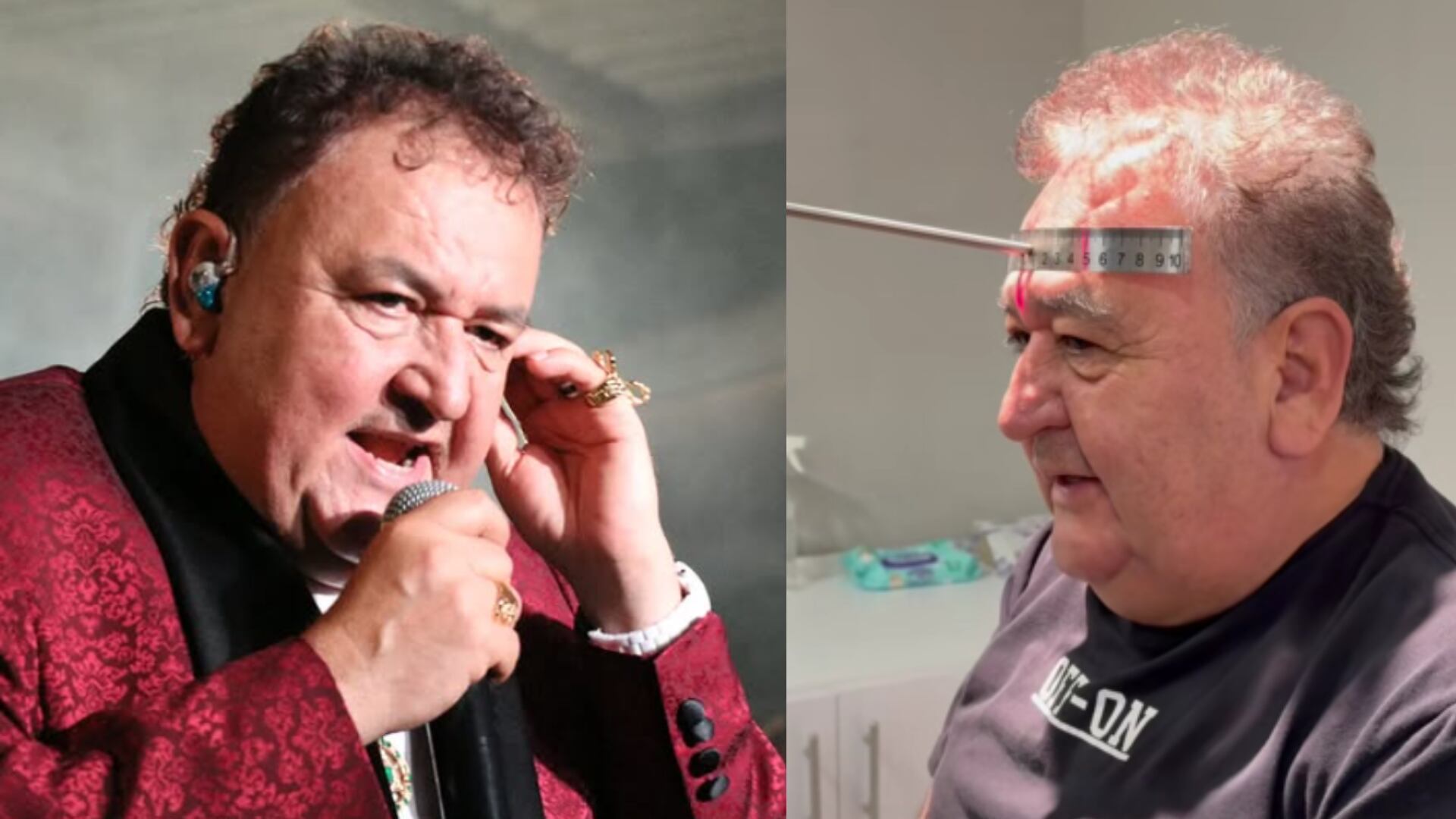 El cantante Darío Darío se sometió a sofisticado trasplante