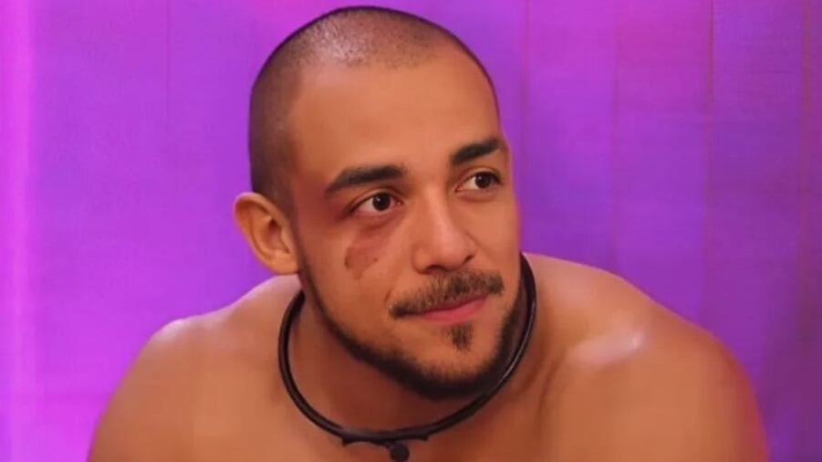 Por medio de las redes sociales Kratos del 'Desafío XX' contó lo que su papá le decía que significaba el lunar con el que nació.