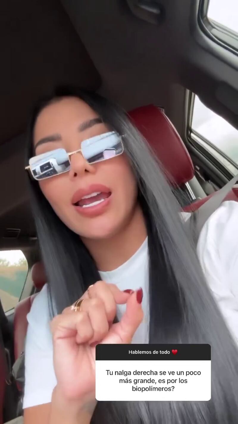 Marcela Reyes contó que está padeciendo un nuevo síntoma por culpa de los biopolímeros