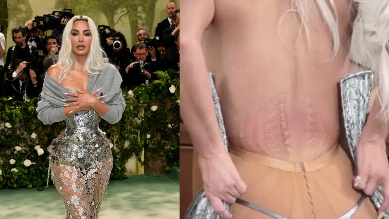 Kim Kardashian mostró el daño que la causó el pequeño corsé que uso en la Met Gala 2024