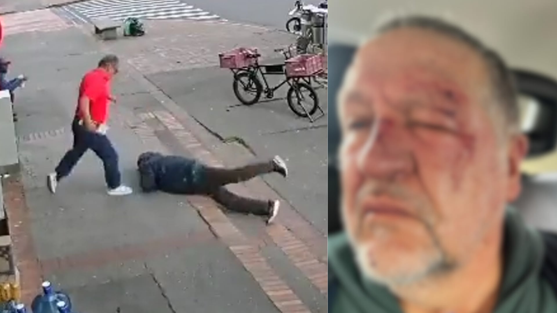 Hombre fue atacado en Bogotá por intentar buscar ayuda al momento de caerse