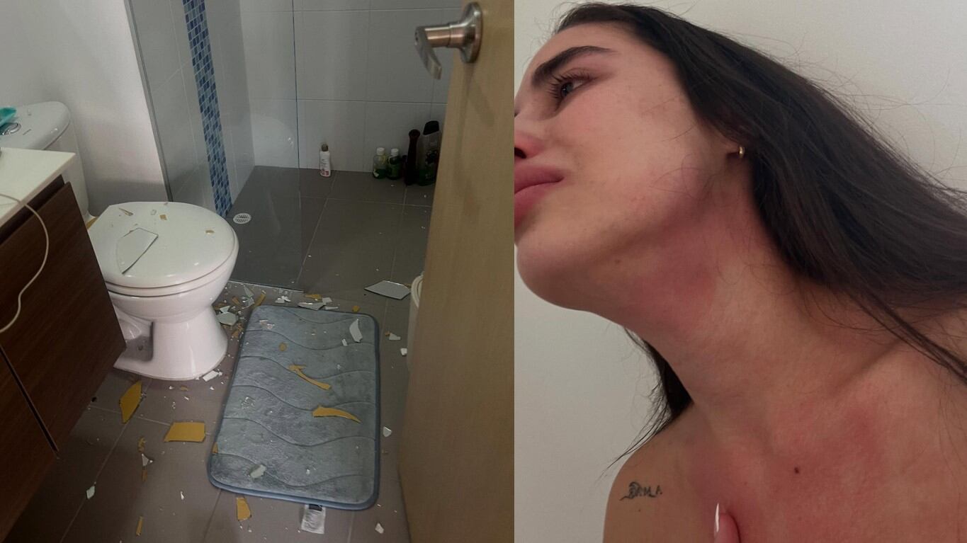 Anamar rompió el silencio sobre la violencia que ha recibido por parte de Renzo del ‘Desafío XX’ y aplauden que lo haya denunciado.