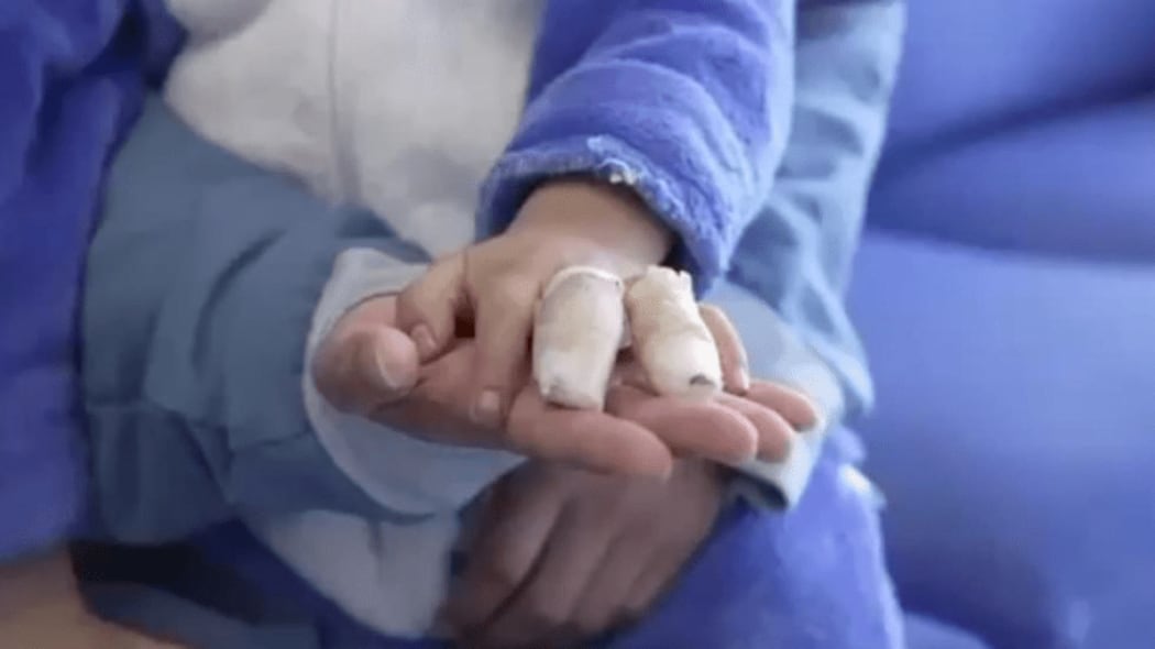 Sube a 81 el número de personas lesionadas con pólvora en Bogotá durante diciembre.