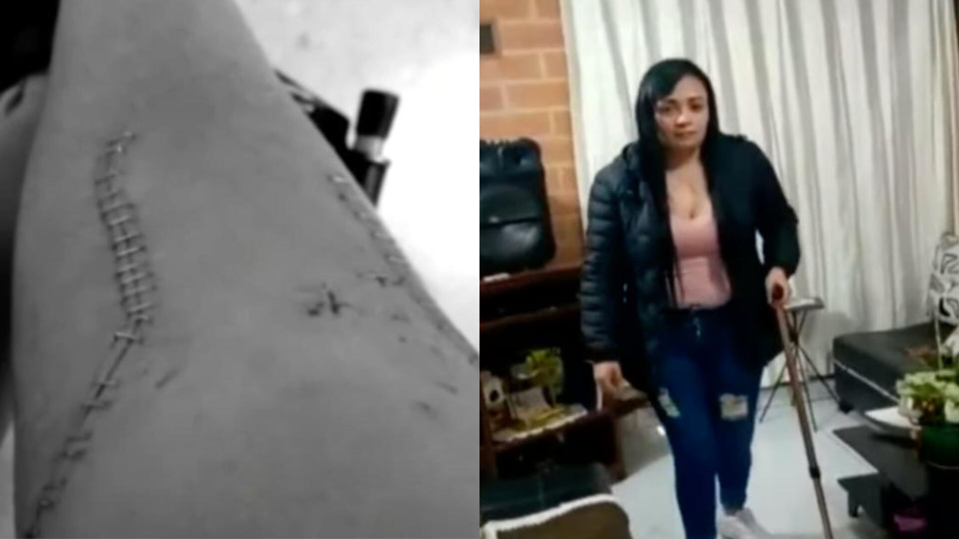 Mujer víctima de atraco en TransMilenio.