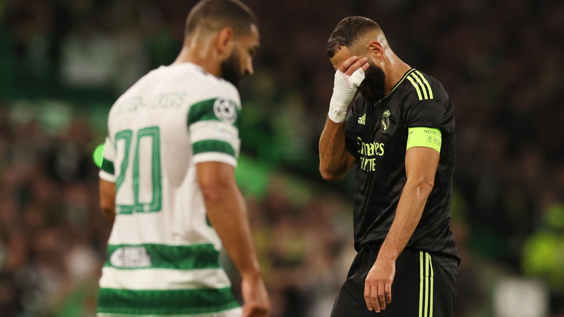 Benzema salió lesionado ante el Celtic.
