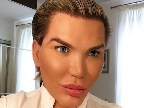 “Ken humano” se quitó 4 costillas y el resultado es aterrador