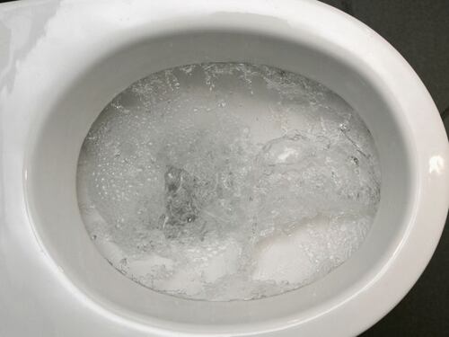 ¿Manchas en el inodoro? Con este ingrediente natural podrás blanquearlo