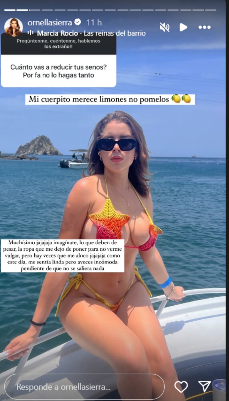 Ornella Sierra de RCN se someterá a delicada cirugía por problema de salud que la acompleja