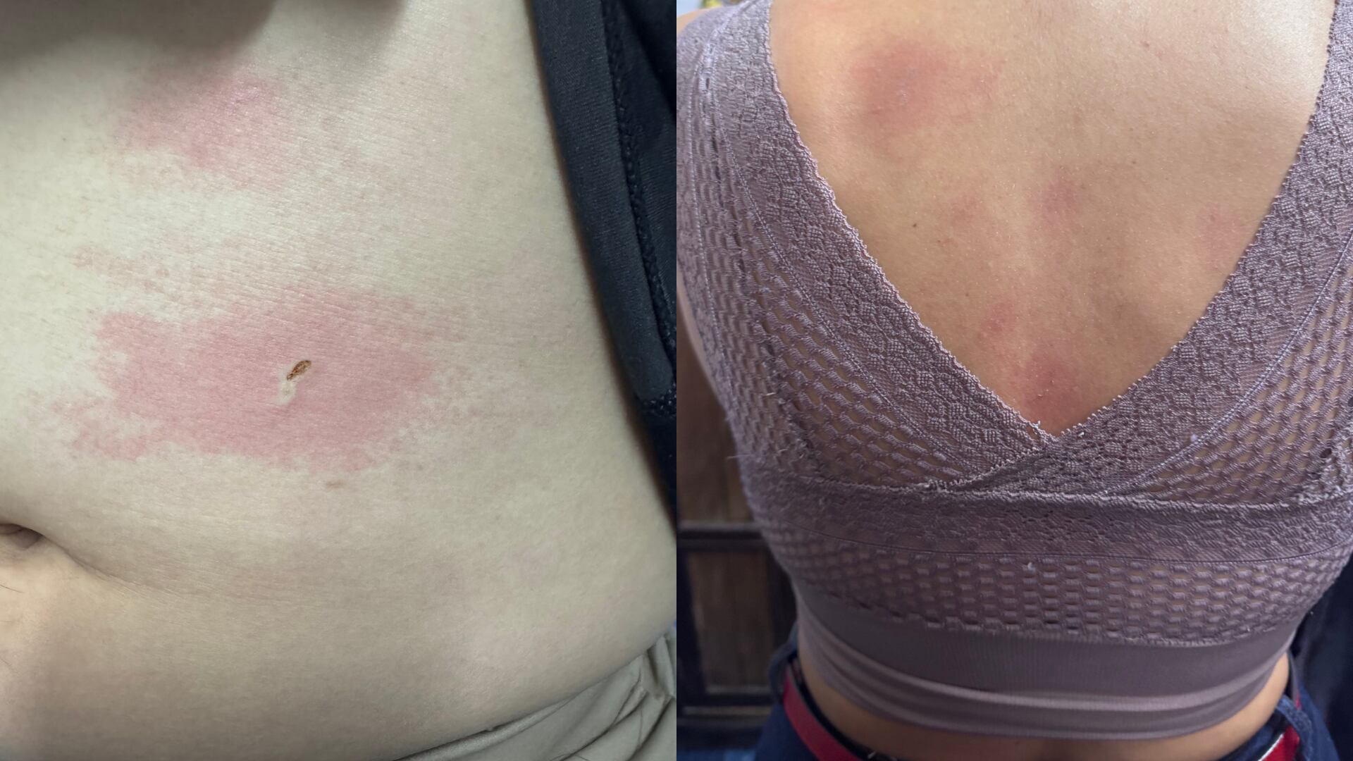 Quemados por máquina de humo en restaurante Andrés DC.