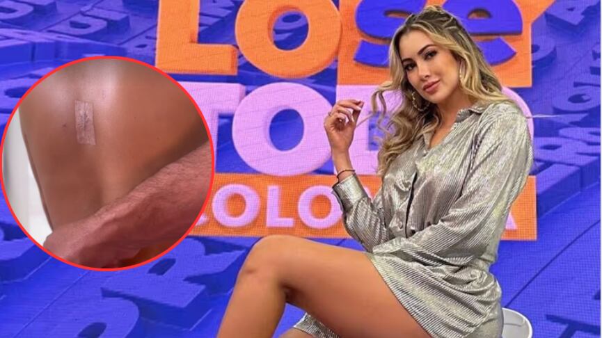 ¿Se quitó las costillas? Nanis Ochoa reapareció luego de someterse a controversial cirugía estética