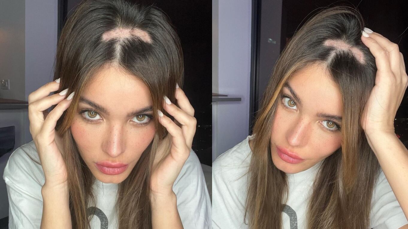 Lo modelo Aleska Genesis mostró a sus seguidores que se está quedando calva contando lo que está sintiendo y pasando en estos momentos.