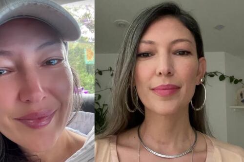 Natalia Durán mostró el angustiante accidente que sufrió en uno de sus ojos