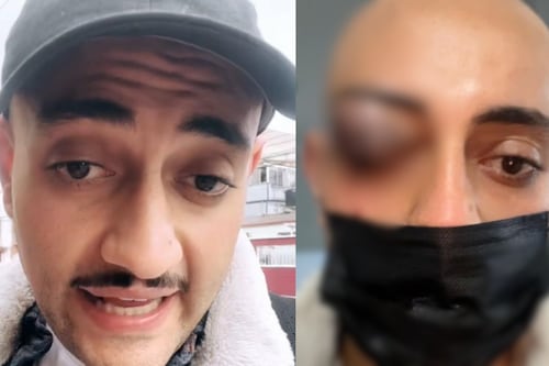 Ibrahim Salem, comediante que se burló de atentado a escuela de Policía, sufrió aparatoso accidente en Bogotá 