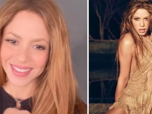 Shakira y los retoques que se ha realizado: Clínica estética pone al descubierto lo que más les solicita la cantante