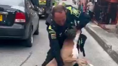 Criticas por acción de Policía que mató a perro pitbull que le mordió la mano.