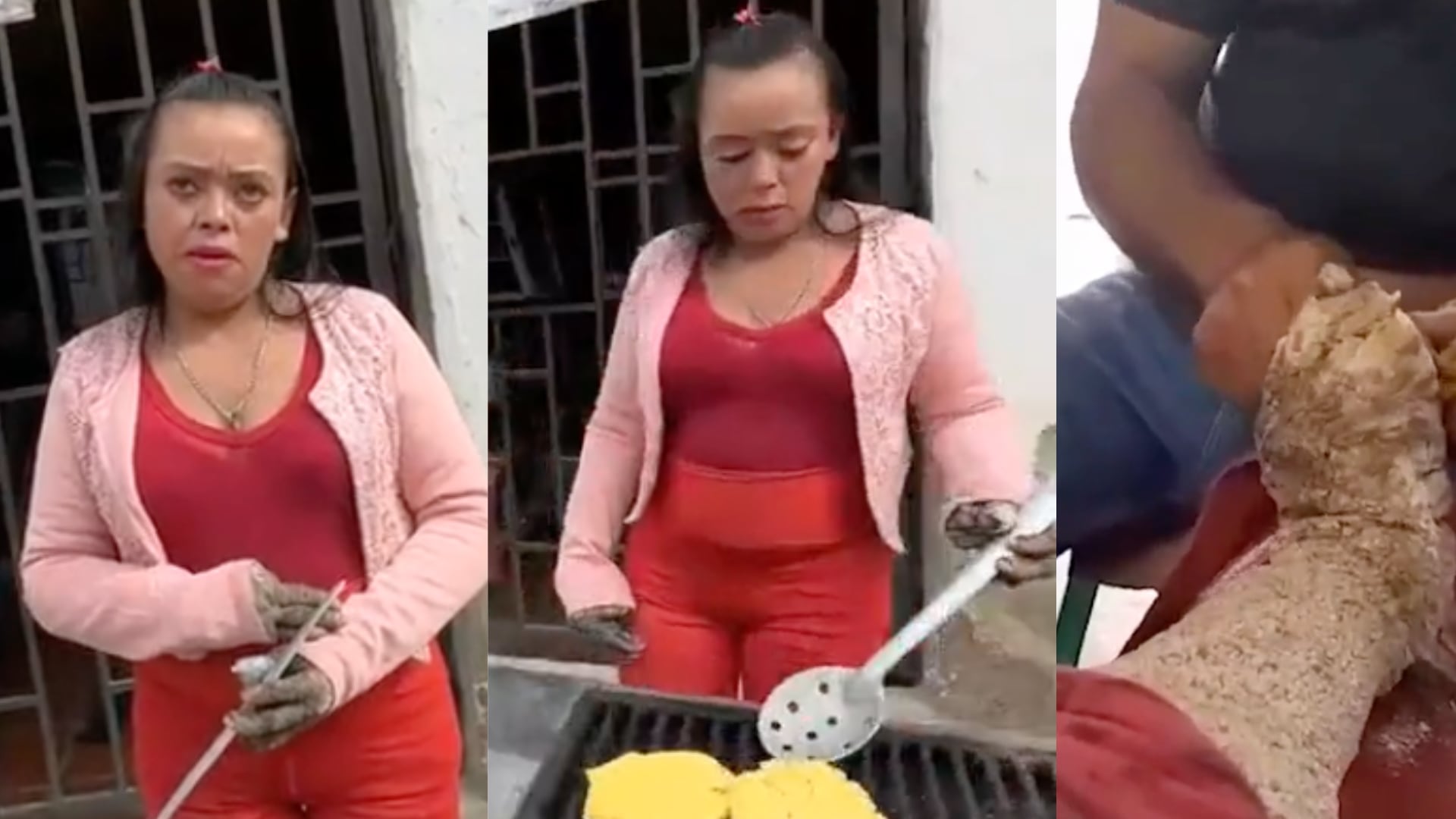 'Mujer árbol' pide ayuda al gobierno colombiano para sus padecimientos