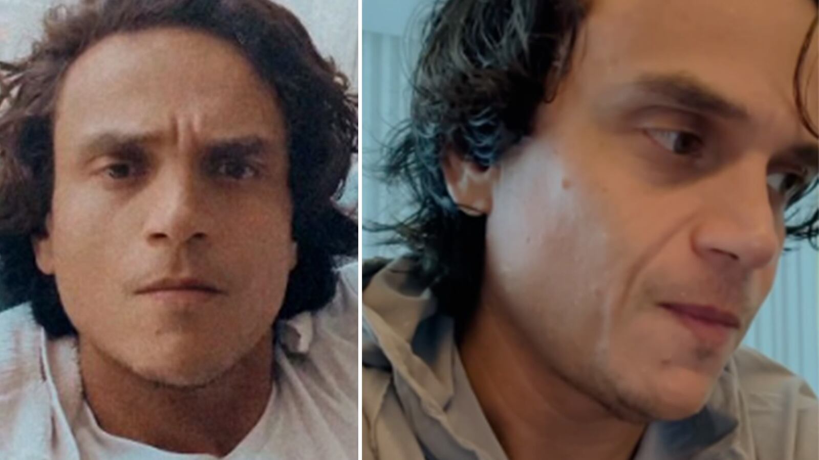 Silvestre Dangond puede verse como quiera luego de una enfermedad que mata a millones.