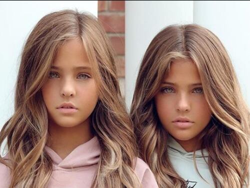 ¿Te acuerdas de las gemelas ‘más bellas del mundo’? Ya tienen 12 años y parecen modelos