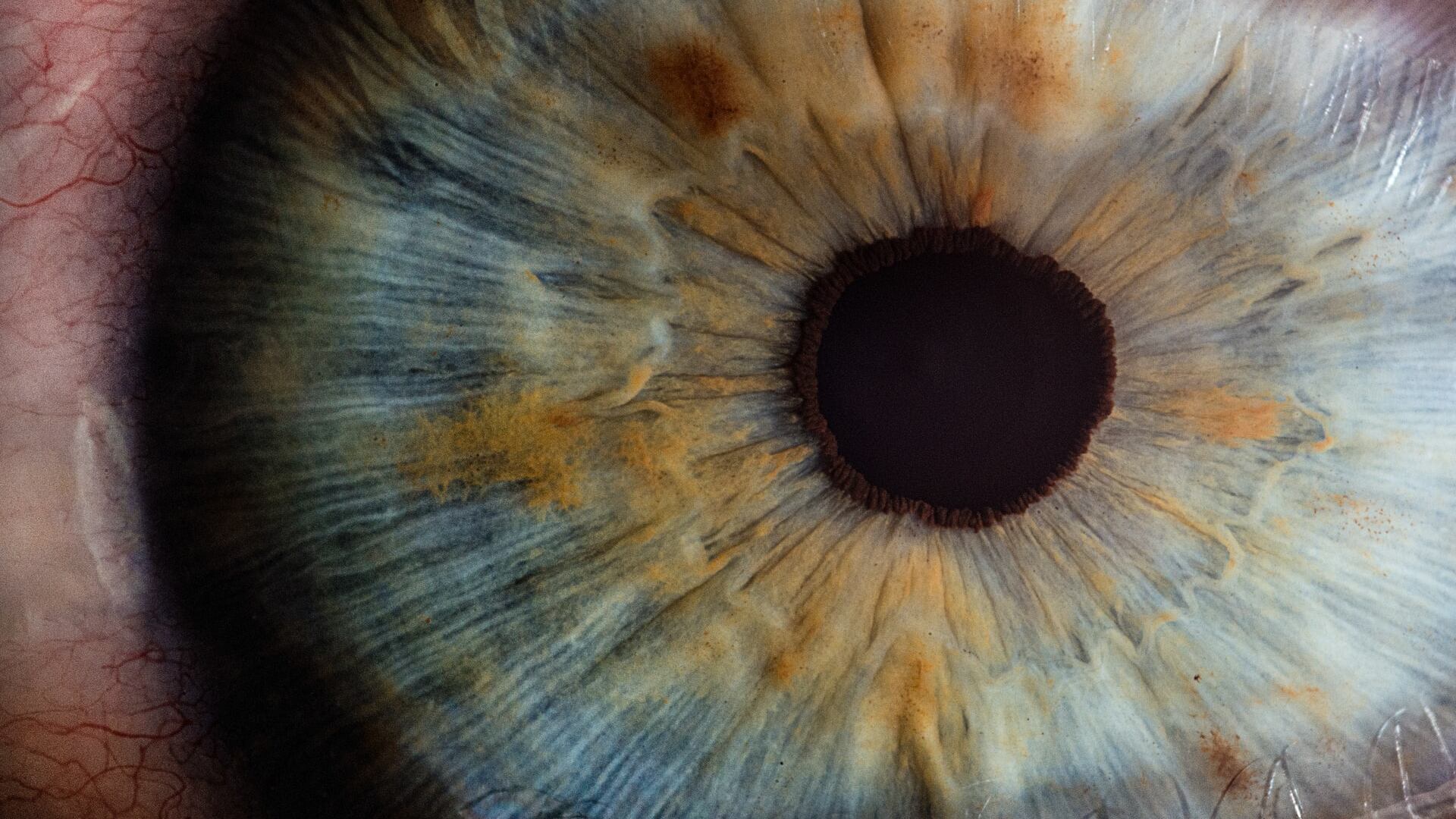 Implantes de córneas fabricadas con colágeno de piel porcina devuelven la vista a 20 personas