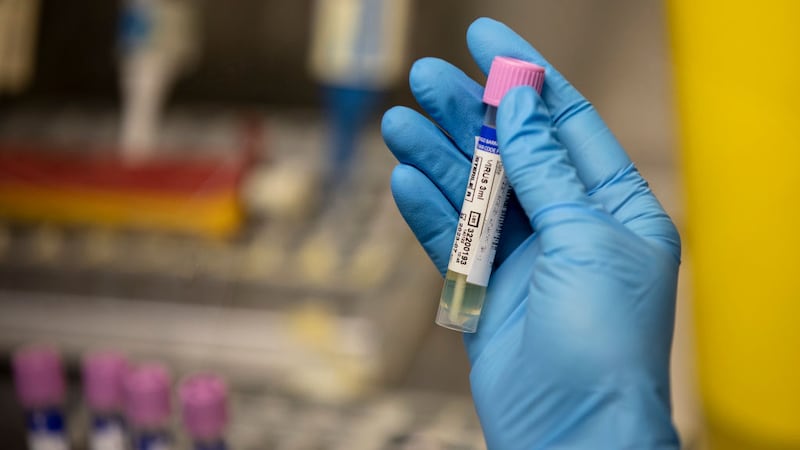 Por ahora, MinSalud descarta la vacunación masiva contra la viruela del mono