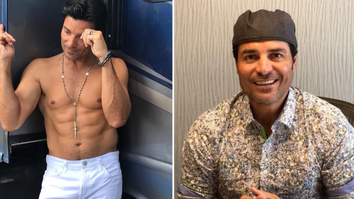 Chayanne fue muy criticado por los cambios en su rostro