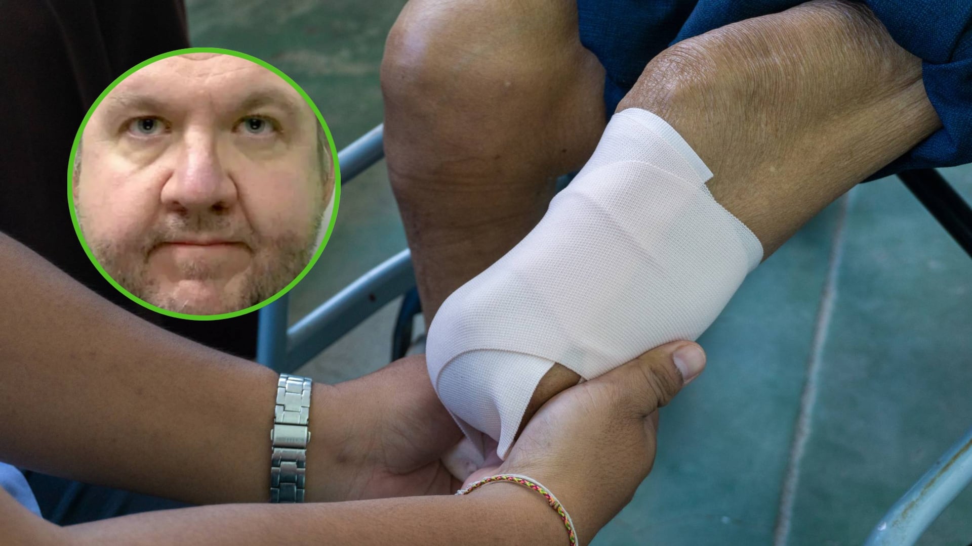 Médico se congela las piernas para amputarlas y cobrar millonario seguro: fue condenado a 32 mese de prisión (archivo y redes sociales)