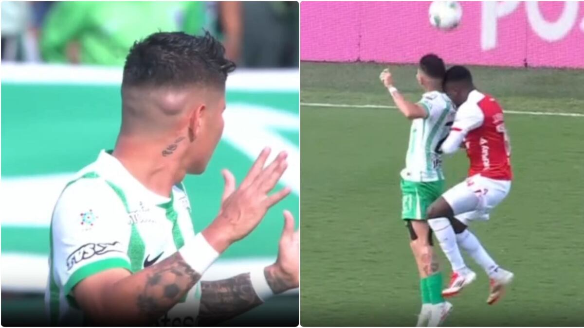 Jorman Campuzano quedó con impresionante chichón tras choque de cabezas en Nacional – Santa Fe
