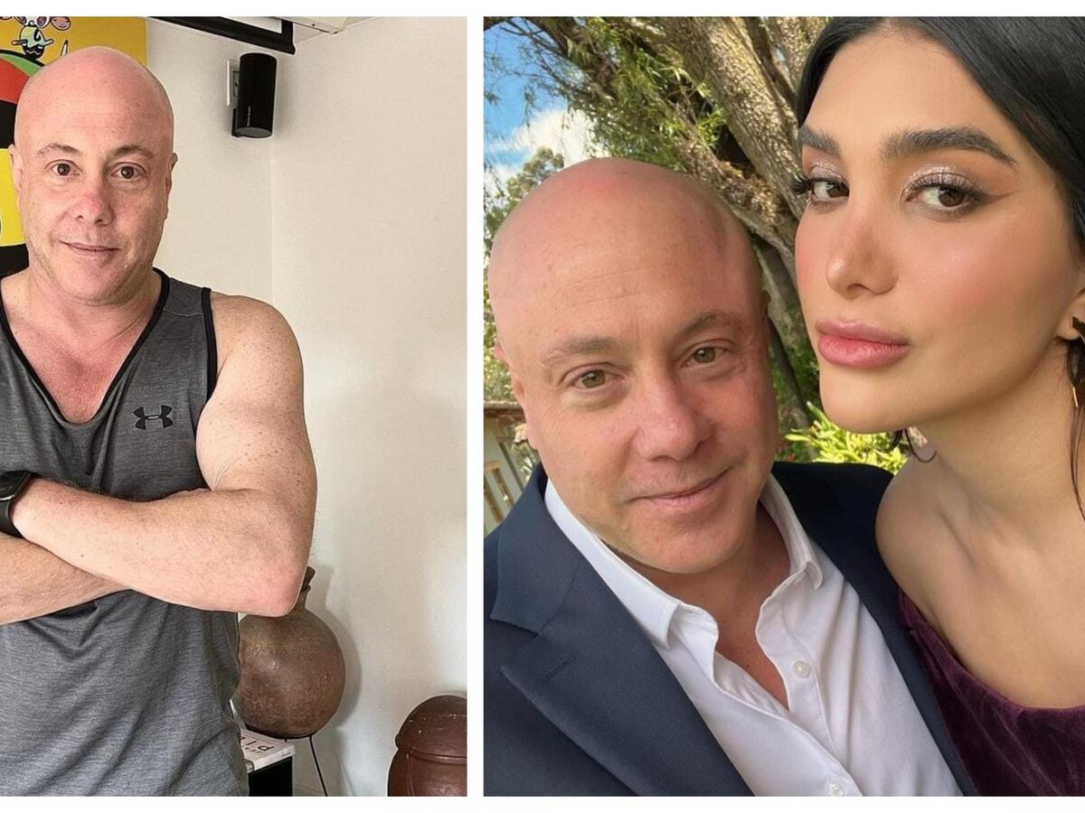 Bạn gái Jorge Rausch của MasterChef Celebrity tiết lộ chứng rối loạn anh gặp phải – Publimetro Colombia