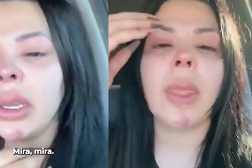 Pareja de famoso cantante estremeció al mostrar las fuertes agresiones recibidas por el hombre