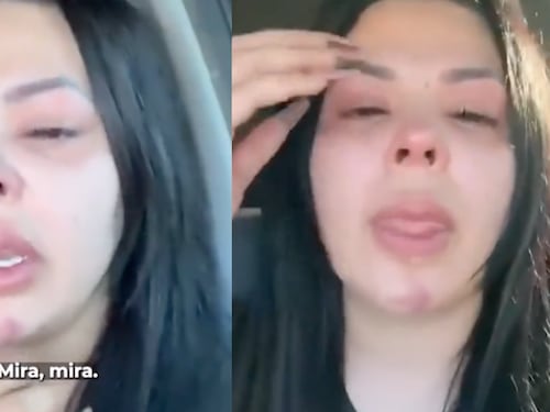 Pareja de famoso cantante estremeció al mostrar las fuertes agresiones recibidas por el hombre