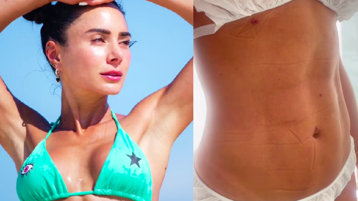Johanna Fadul y así quedó su lindo cuerpo después de pasar por el quirófano