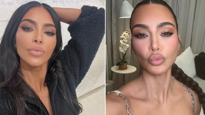 La revelación de Kim Kardashian sobre tener “demasiado bótox” que asombró: ya ni mueve las cejas