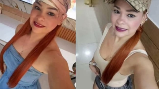 Foto de víctima de 'La Mela”: la liposucción artesanal sin anestesia ni control que enciende las alarmas tras una muerte.